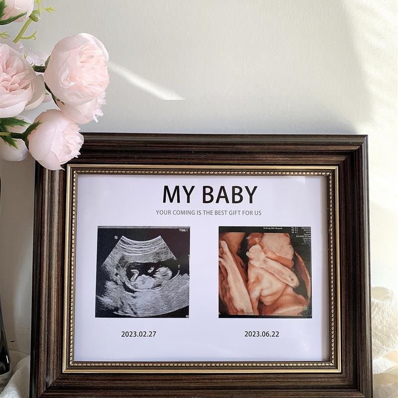 。宝宝四维照片相框孕期NT B超图打印婴儿出生礼物摆台纪念照