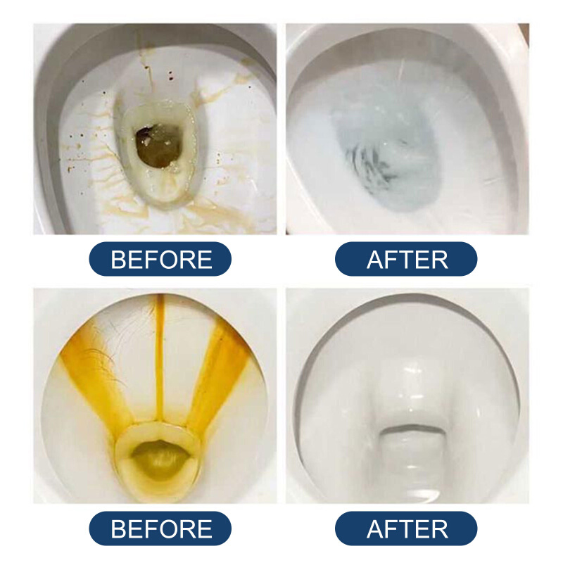 Jue-Fish 马桶泡腾片 坐便器清洁黄渍尿渍污垢洁厕厕所除臭去异味